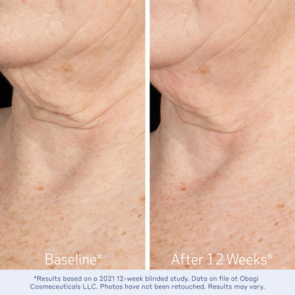 Obagi ELASTIderm Neck & Décolleté Lifting Concentrate with Patented Bi-Mineral Contour Complex, Retinoid & Alpha-Arbutin Clinically Proven to Reduce Fine Lines & Wrinkles – 2 oz