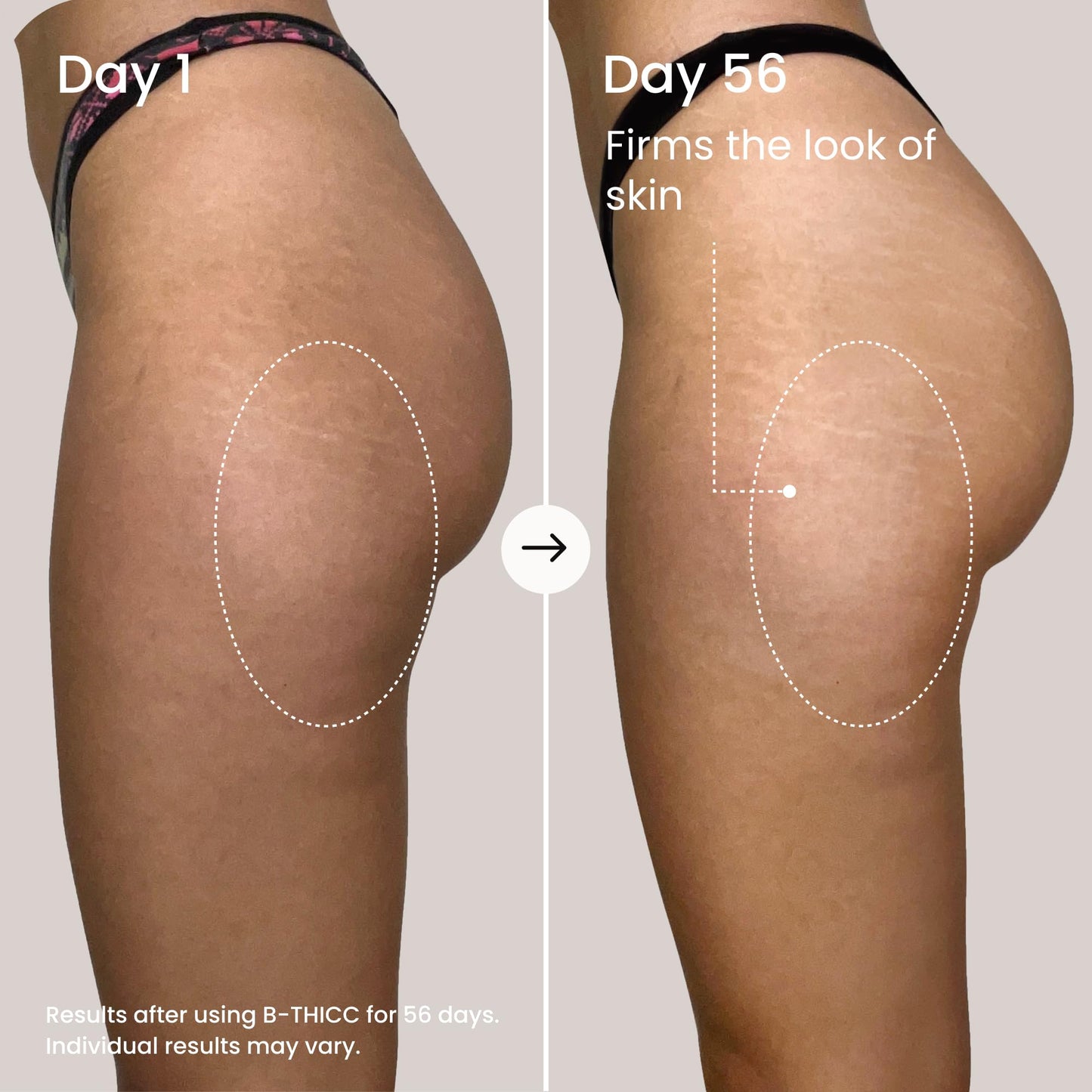 MAËLYS Full Body Reshaping Bundle - B-TIGHT Lift & Firm Booty Mask - B-THICC Booty Enhancing Mask - B-FLEX Firming Arm Cream - B-FLAT Belly Firming Body Cream - B-FOXY Inner Thigh Firming Cream