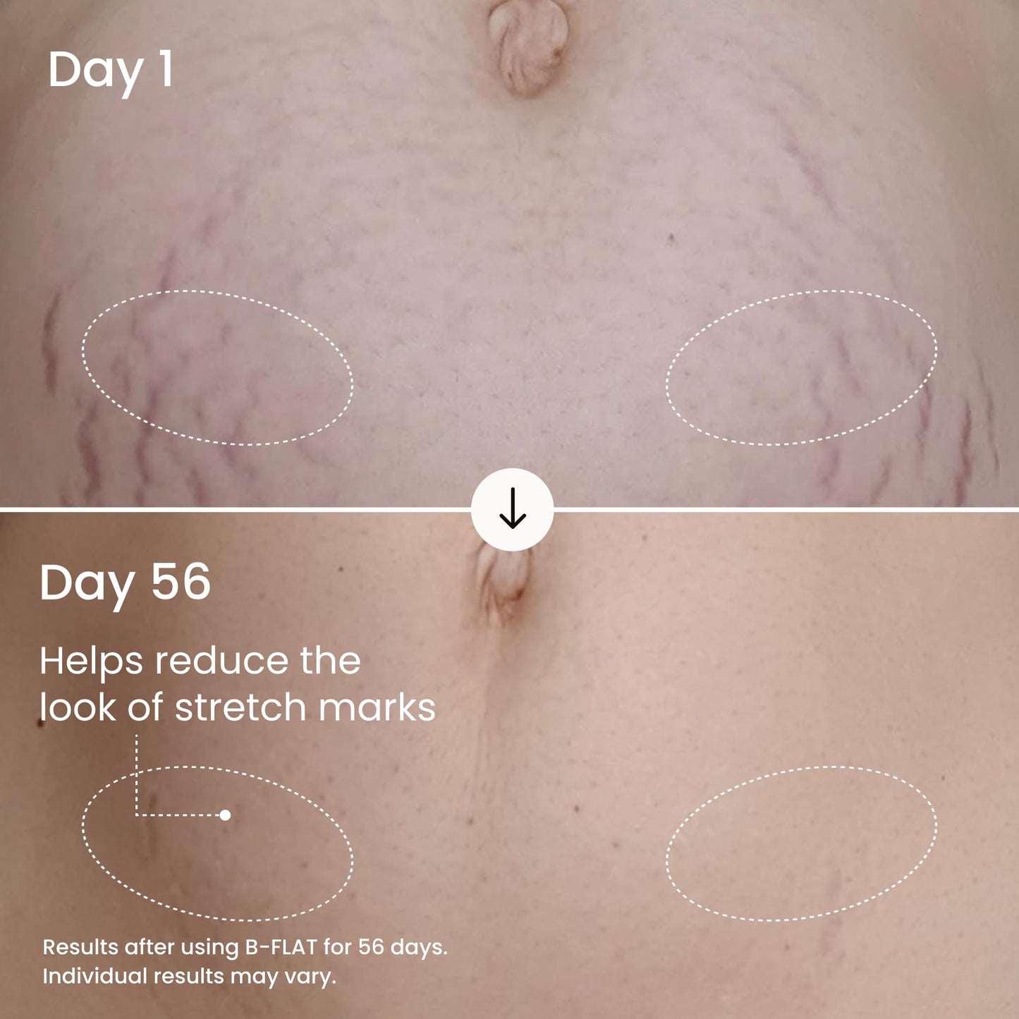 MAËLYS Full Body Reshaping Bundle - B-TIGHT Lift & Firm Booty Mask - B-THICC Booty Enhancing Mask - B-FLEX Firming Arm Cream - B-FLAT Belly Firming Body Cream - B-FOXY Inner Thigh Firming Cream