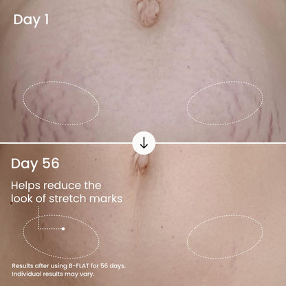 MAËLYS Full Body Reshaping Bundle - B-TIGHT Lift & Firm Booty Mask - B-THICC Booty Enhancing Mask - B-FLEX Firming Arm Cream - B-FLAT Belly Firming Body Cream - B-FOXY Inner Thigh Firming Cream
